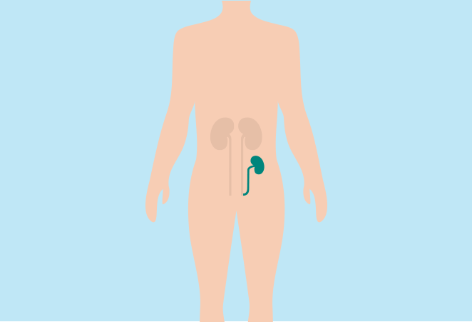 Was ist eine Nierentransplantation?